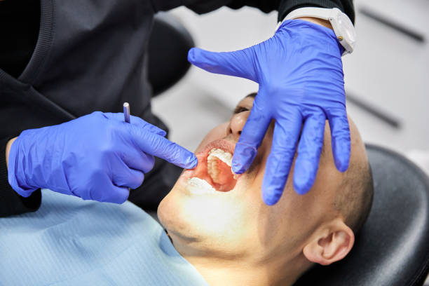 Best Emergency Treatment for Dental Infections or Abscesses in Alto, GA